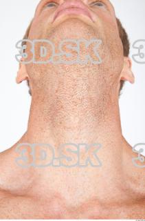 Neck texture of Alberto 0001